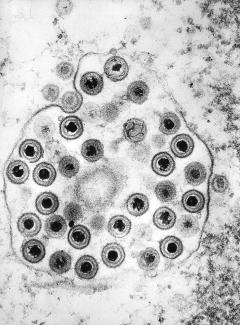 Microscopy of Herpesvirus